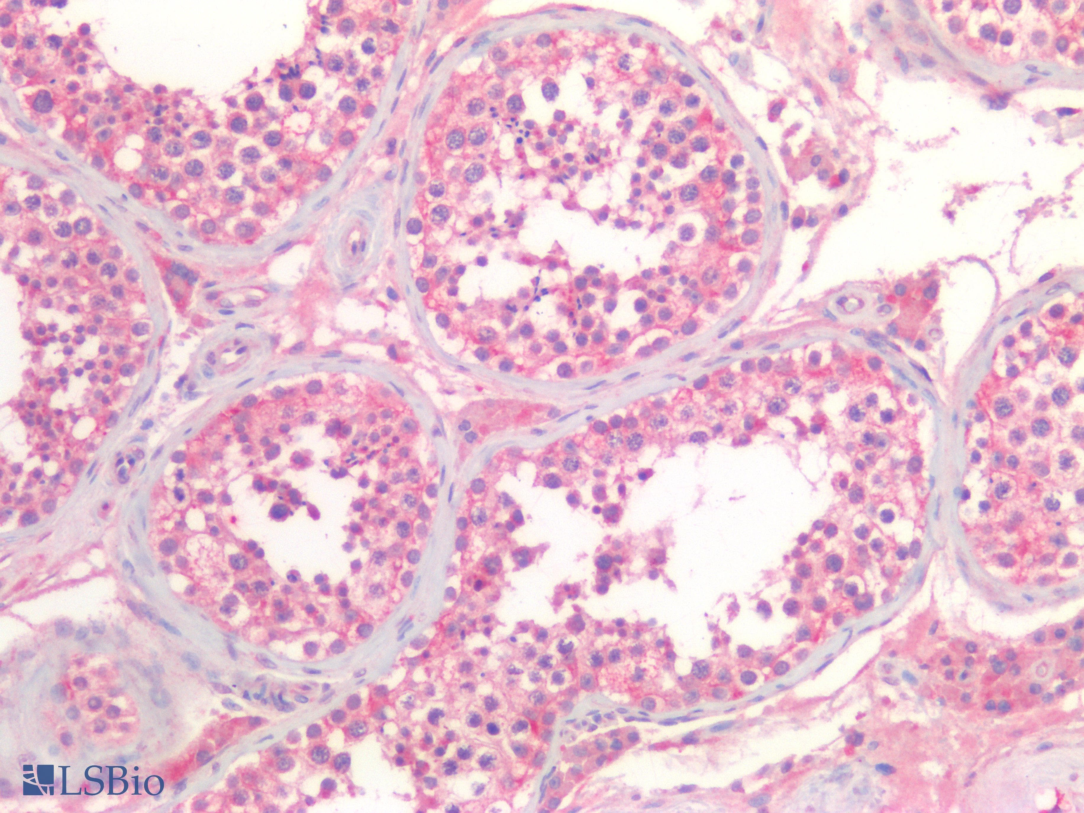PathPlus™ Polyclonal Rabbit anti-Human TJP1 / ZO-1 Antibody (IHC)