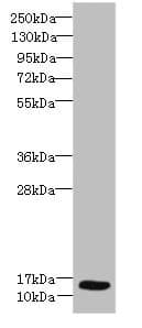SCA2 / LY6E Antibody (aa21-102)