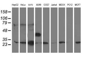PGAM2 Antibody (clone OTI2H10, Carrier-free)