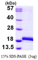 Human MAP1LC3B / LC3B Protein (Recombinant His)