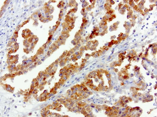 SQSTM1 Antibody (clone UMAB13, Carrier-free)
