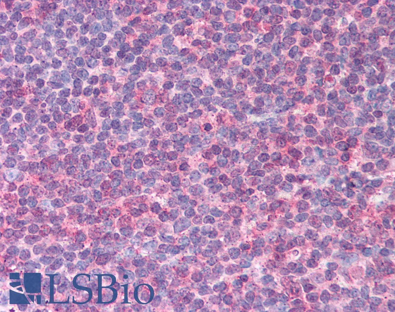 IHC-plus™ Monoclonal Mouse anti-Human IL6 / Interleukin 6 Antibody (clone 6D9A1, IHC, WB)