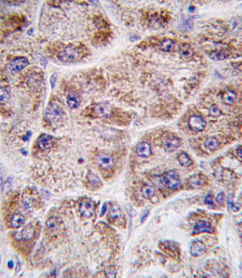 Polyclonal Rabbit anti-Human FDPS Antibody (aa389-419, IHC, WB)