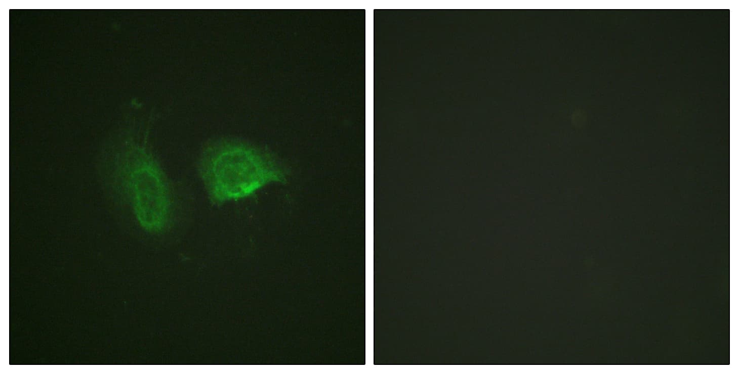 Polyclonal Rabbit anti-Human CASR/Calcium Sensing Receptor Antibody (phospho-Thr888, IF, WB)