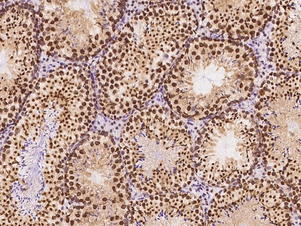 CBX1 / HP1 Beta Antibody