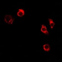 FTHFSDC1 / MTHFD1L Antibody