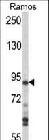 MAP4K1 / HPK1 Antibody (aa321-350)