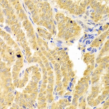 Polyclonal Rabbit anti-Human CD121b / IL1R2 Antibody (IHC, WB)