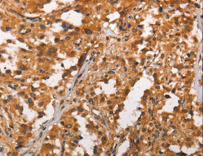 CRKL Antibody