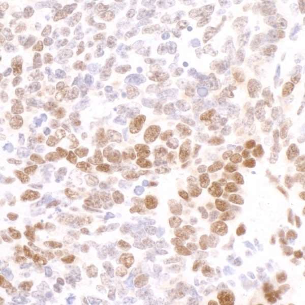 POLR2A / RNA polymerase II Antibody (phospho-Ser2)