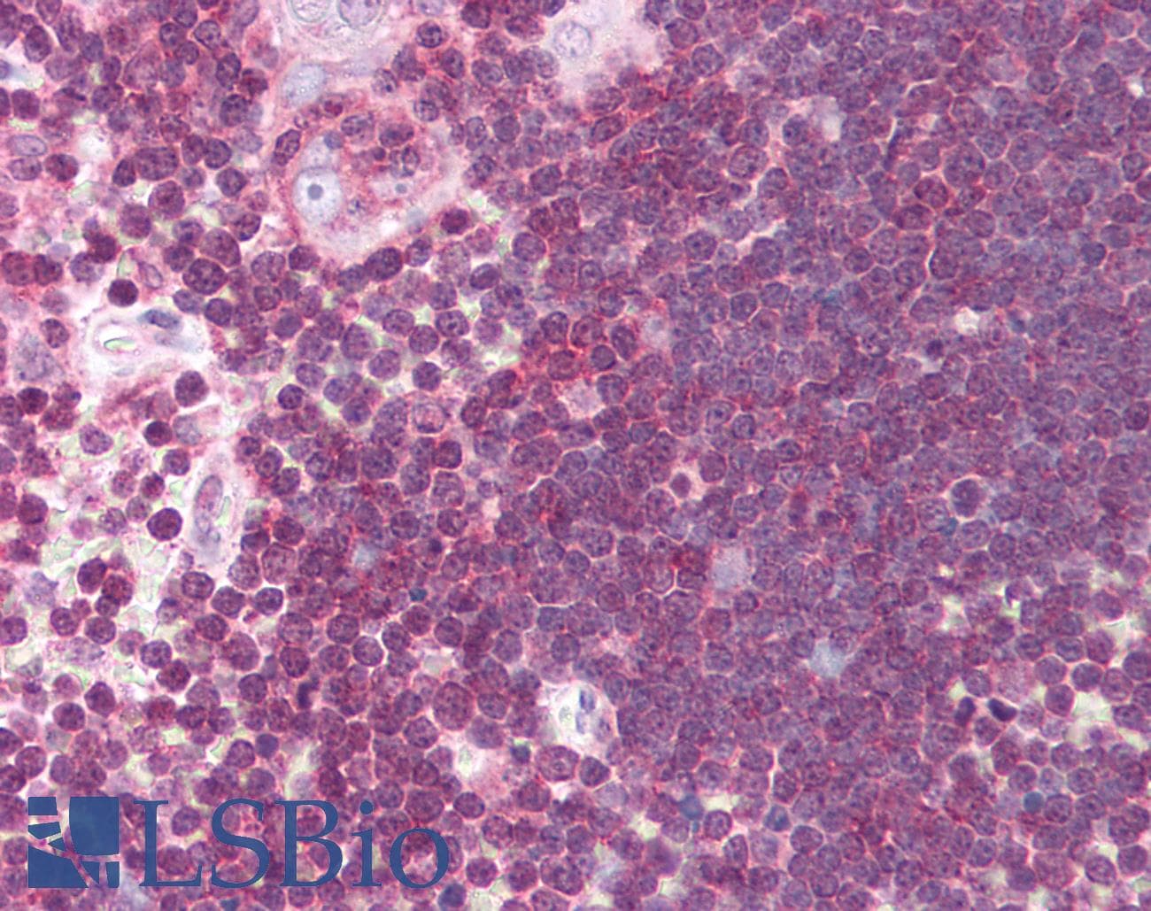 IHC-plus™ ALOX5 / 5-LOX Antibody (aa130-149)