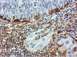 Monoclonal Mouse anti-Human TAGLN / Transgelin / SM22 Antibody (clone 8C8, Carrier-free, IHC, IF, WB)