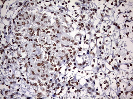 DDX56 Antibody (aa323-547, clone OTI5C1)