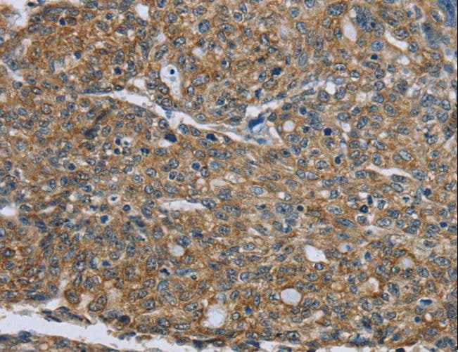 Polyclonal Rabbit anti-Human KRT5 / CK5 / Cytokeratin 5 Antibody (IHC)