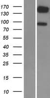 Human PDE3B Protein (Over-Expression Lysate Myc-DDK (Flag))