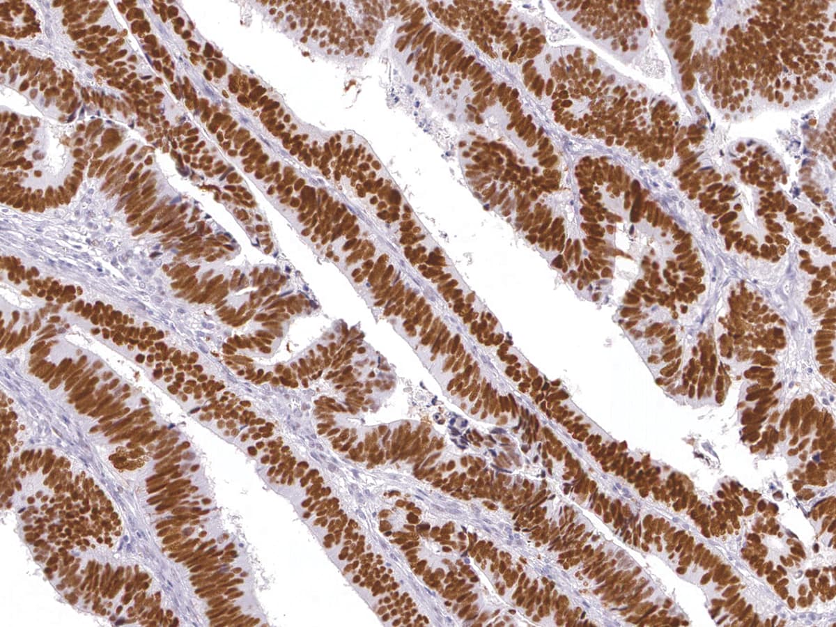 PathPlus™ TP53 / p53 Antibody (Concentrated)
