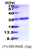Human RAB6B Protein (Recombinant His)