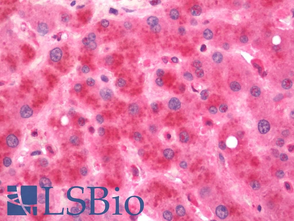 IHC-plus™ COMMD1 Antibody (clone 2E2)