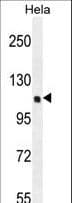 SIK3 / QSK Antibody (aa1233-1263)