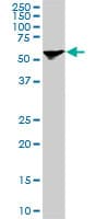 IHC-plus™ Monoclonal Mouse anti-Human STI1 / STIP1 Antibody (clone 1E3, IHC, IF, WB)