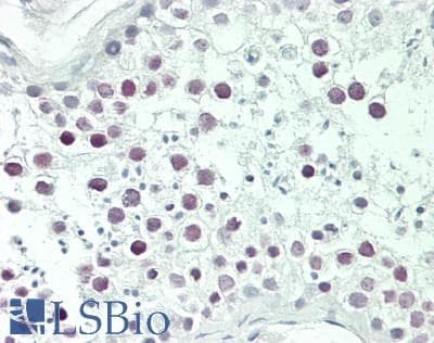 IHC-plus™ Polyclonal Rabbit anti-Human TPR Antibody (aa1650-1700, IHC, WB)