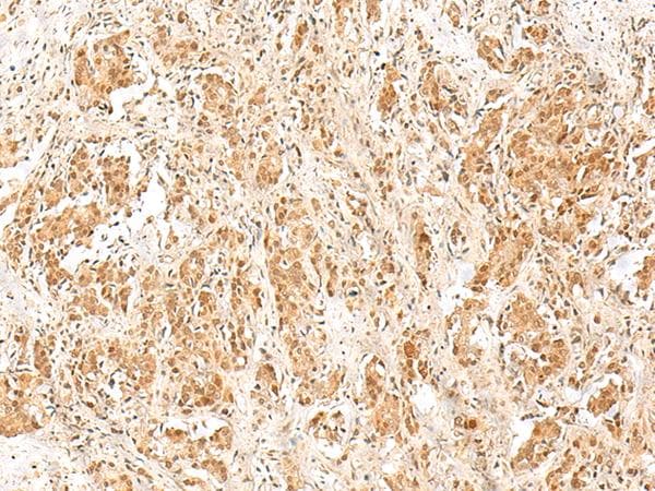 RPS27A Antibody