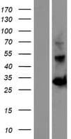 OGFOD2 Protein (Over-Expression Lysate Myc-DDK (Flag))