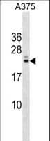 Polyclonal Rabbit anti-Human RYBP Antibody (aa1-30, WB)