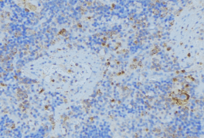 TFPI / LACI Antibody