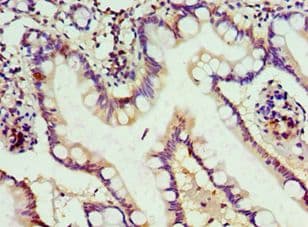 Polyclonal Rabbit anti-Human ABH2 / ALKBH2 Antibody (aa1-261, IHC)