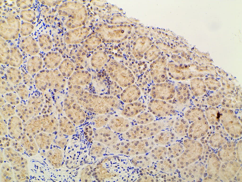 PIK3R1 / p85 Alpha Antibody (phospho-Tyr607)