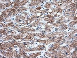 KHK / Ketohexokinase Antibody (clone OTI1D8)