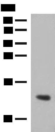 Polyclonal Rabbit anti-Human Hemoglobin Gamma (HBG1 + HBG2) Antibody (IHC, WB)