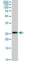 IHC-plus™ Monoclonal Mouse anti-Human EFHD1 Antibody (clone 1H7, IHC, IF, WB)