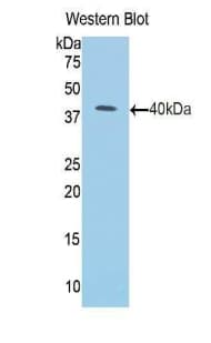 KRT1 / CK1 / Cytokeratin 1 Antibody (aa189-497, PE)