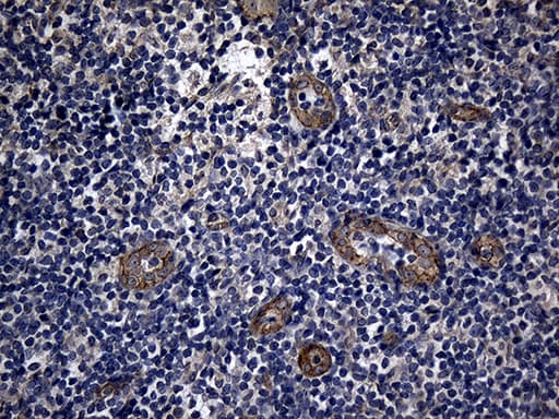 AFAP1 / AFAP Antibody (clone OTI2A3, Carrier-free)