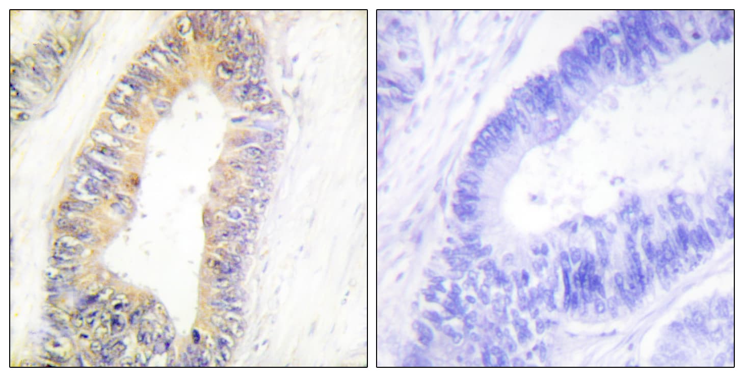 ZNF638 Antibody (aa1271-1320)