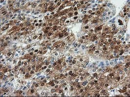 ACY1 / Aminoacylase 1 Antibody (clone OTI16C1)