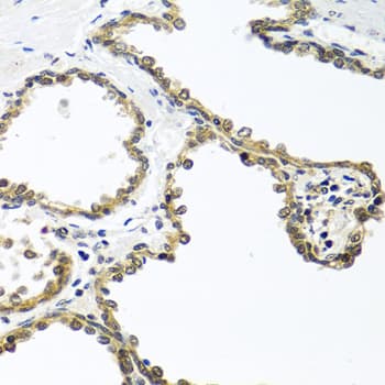ARSF / Arylsulfatase F Antibody