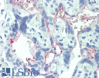 IHC-plus™ INHBB / Inhibin Beta B Antibody