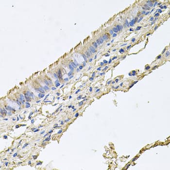Polyclonal Rabbit anti-Human EPOR / EPO Receptor Antibody (IHC, WB)