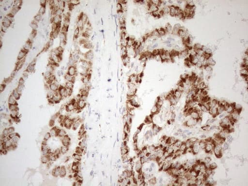 NAPSA / NAPA / Napsin A Antibody (aa64-244, clone OTI3E5)