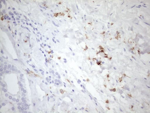 FBP / FOLR2 Antibody (aa20-221, clone OTI4G6)