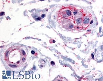 PathPlus™ PTPRE / PTP Epsilon Antibody (Cytoplasmic Domain)