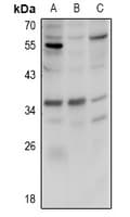 Polyclonal Rabbit anti-Human FBP / FOLR2 Antibody (WB)