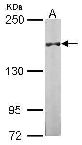 DIP2B Antibody (aa1168-1427)