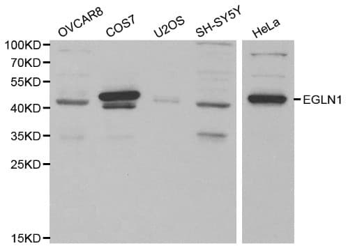 Polyclonal Rabbit anti-Human EGLN1 / PHD2 Antibody (IHC, WB)