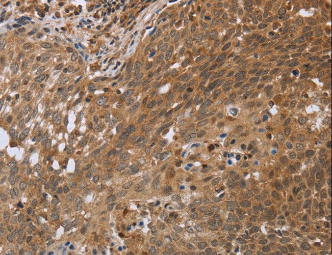 NDUFS2 Antibody