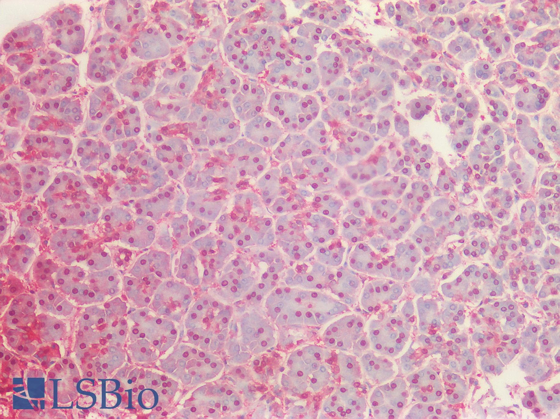 IHC-plus™ Polyclonal Goat anti-Human GAPDH Antibody (aa279-290, IHC, IF, WB)