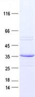 Human RET Protein (Recombinant DDK,C-terminus)